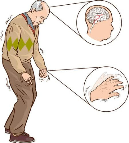 Thé qui guérit de l'AVC et de la paralysie
